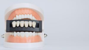 full arch dental implants, implant-supported dentures, number of implants for full arch, full mouth restoration implants, full arch implant options, dental implant consultation, full arch implant procedure, implant restorations, immediate load implants, full arch rehabilitation